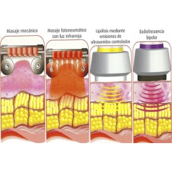 Equipo remodelacion corporal Lumicel Wave6